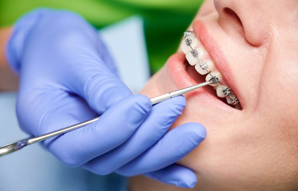 Adult having braces adjusted